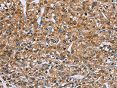 PSCA Antibody