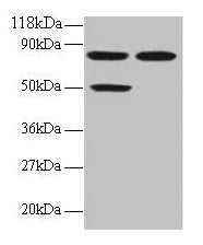 CCL22 Antibody