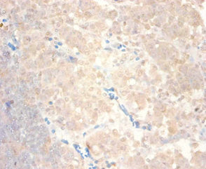 CCL24 Antibody