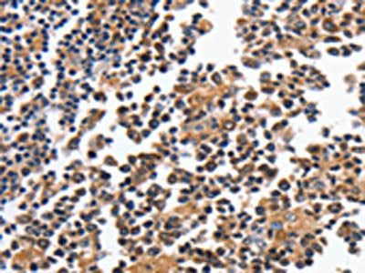 MAGEA4 Antibody