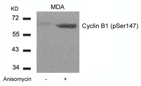 Phospho-CCNB1 (Ser147) Antibody