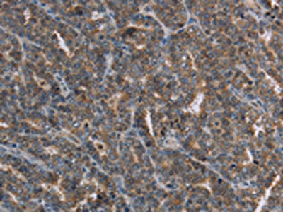 FGF20 Antibody