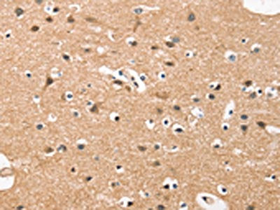 HDAC8 Antibody