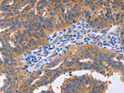 NBEA Antibody