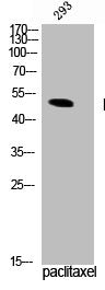 Phospho-TPH1 (S58) Antibody