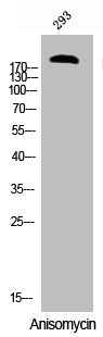 Phospho-TSC2 (S939) Antibody