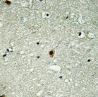 Phospho-HIRA (T555) Antibody