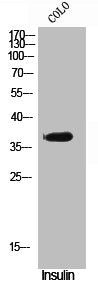 Phospho-VDR (S51) Antibody