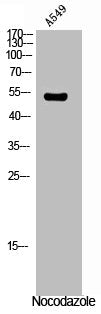 Phospho-VIM (S56) Antibody