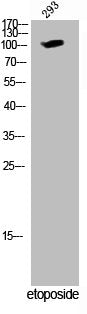 Phospho-WEE1 (S642) Antibody