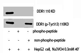 DDR1 Antibody