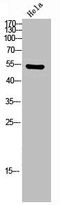 Phospho-CAMK2A/CAMK2D (T286) Antibody