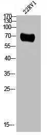 Phospho-CAMK2B/CAMK2G/CAMK2D (T287) Antibody