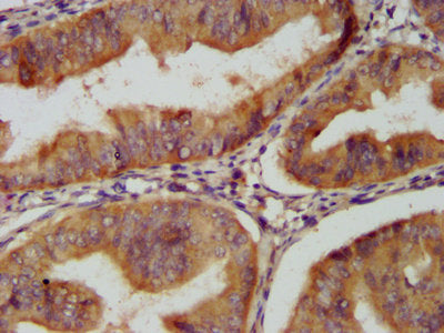 CLU Antibody