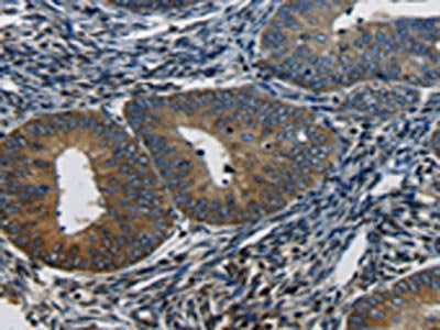 CTGF Antibody