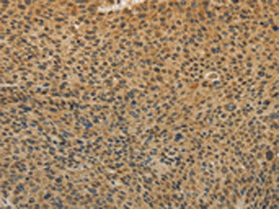 TGFB1 Antibody