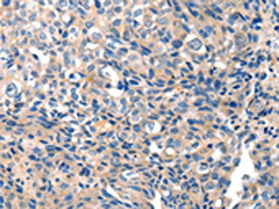 GRIN2D Antibody