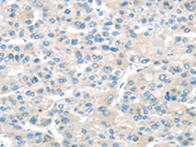TMPRSS11A Antibody