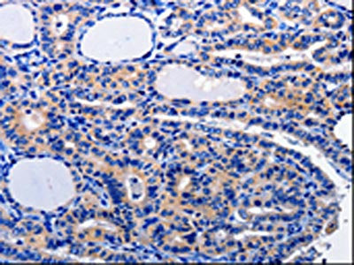 CAMK2B Antibody