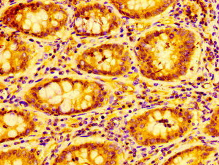 CXCL9 Antibody