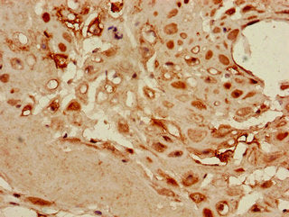 DKK1 Antibody