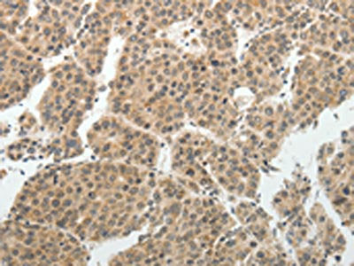 SOCS7 Antibody