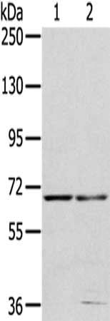 MMP24 Antibody