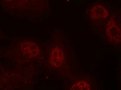 Phospho-MYC (Ser62) Antibody