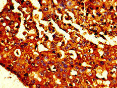 CDH1 Antibody