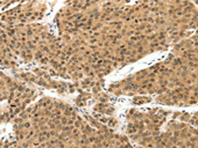 TERF2 Antibody