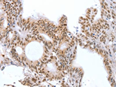 CTBP2 Antibody