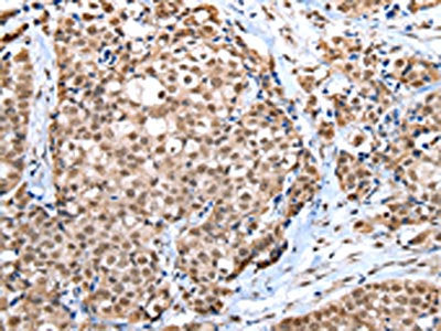 WDR5 Antibody