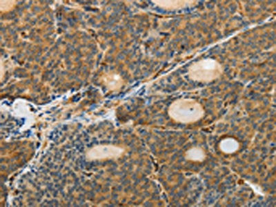 MSN Antibody