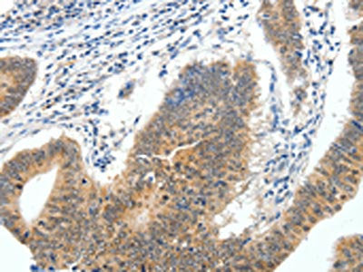 ECE2 Antibody