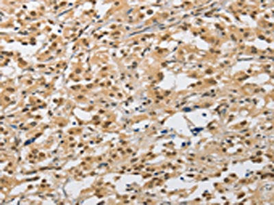 AMZ2 Antibody
