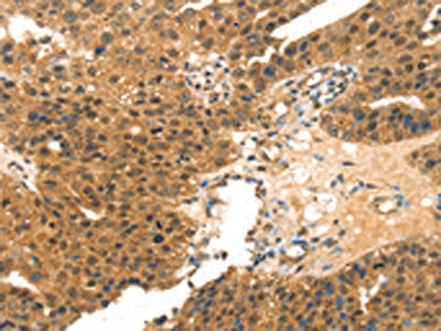 MED14 Antibody