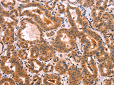 NCEH1 Antibody