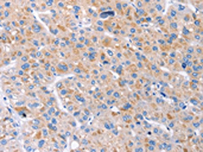 GAS1 Antibody