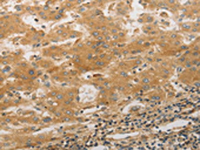 PPAP2A Antibody