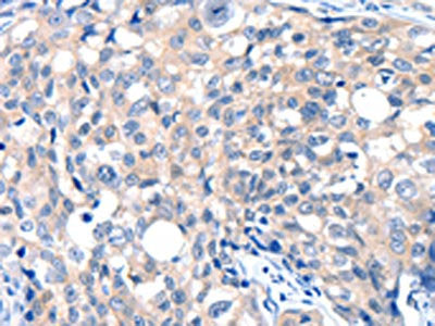 GRIN2D Antibody