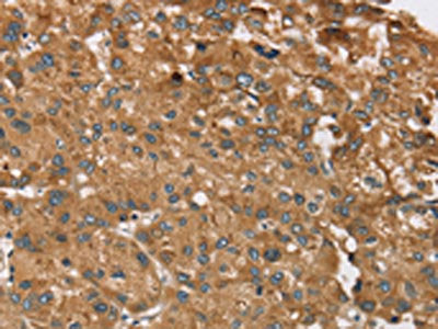 RPS6KA2 Antibody