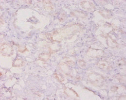 CSF3 Antibody