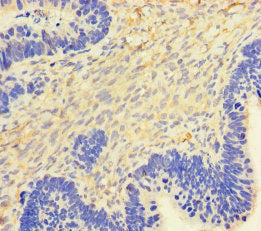 CSF2 Antibody