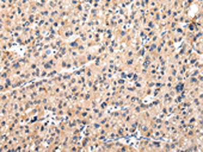 MUC1 Antibody