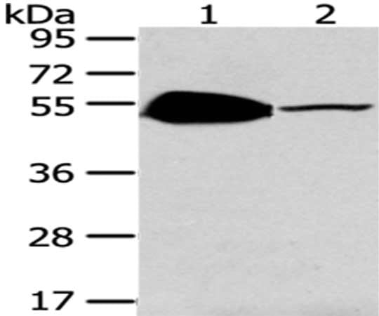 TSPYL1 Antibody