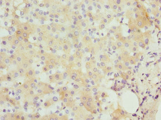 IFNB1 Antibody
