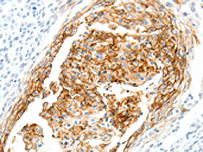 SEMA3D Antibody
