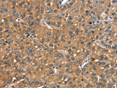 CR1 Antibody