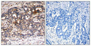 SHC1 (Ab-427) Antibody