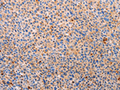 PLIN2 Antibody